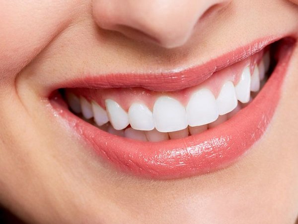Smile Makeover